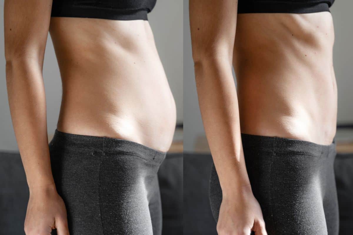 Post-Pregnancy: What Happens to Your Abdominal Muscles After Birth Holmes Chapel