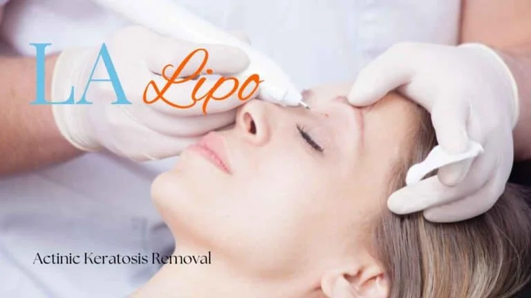 Woman receiving Actinic Keratosis Removal Treatment Holmes Chapel