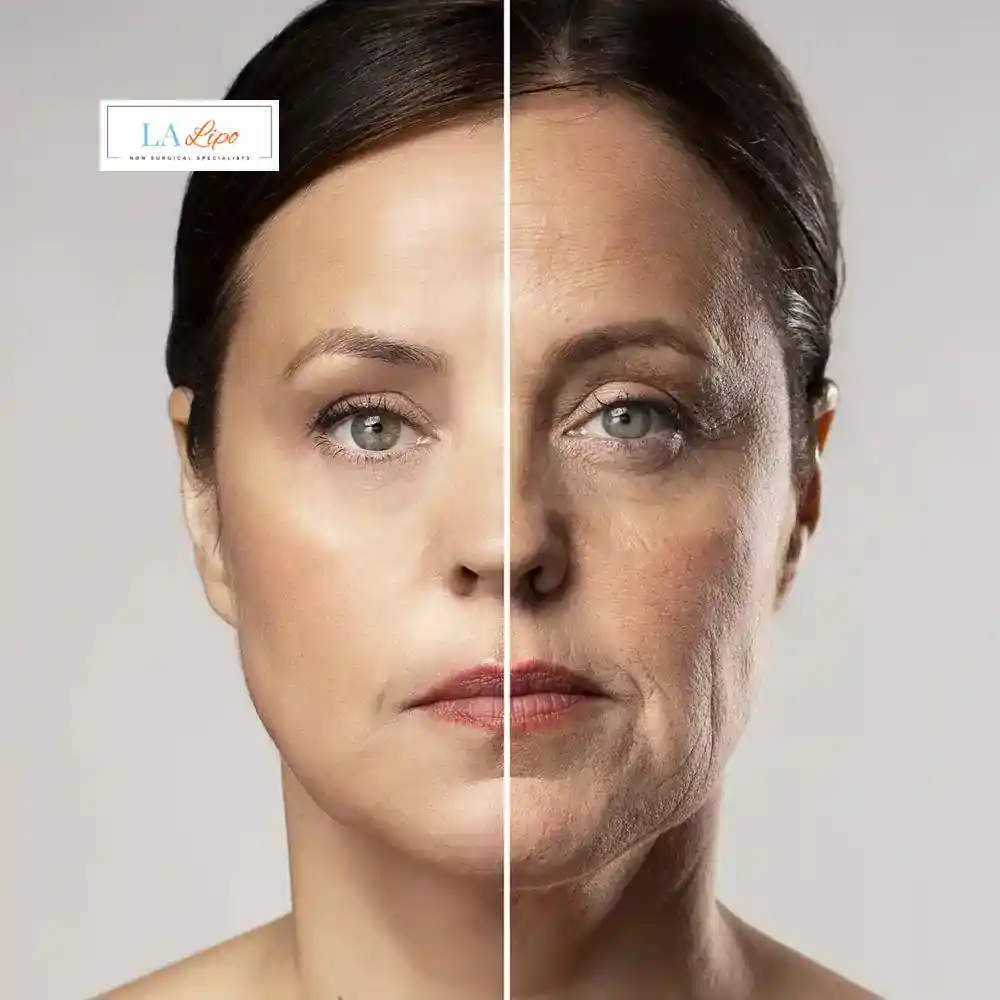 How Can You Tell If Non-Surgical Skin Tightening Is Right for You Holmes Chapel?
