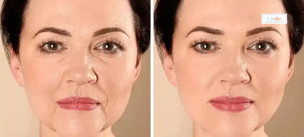 Why Aren’t My Skincare Products Making My Sagging Skin Look Firmer Holmes Chapel?