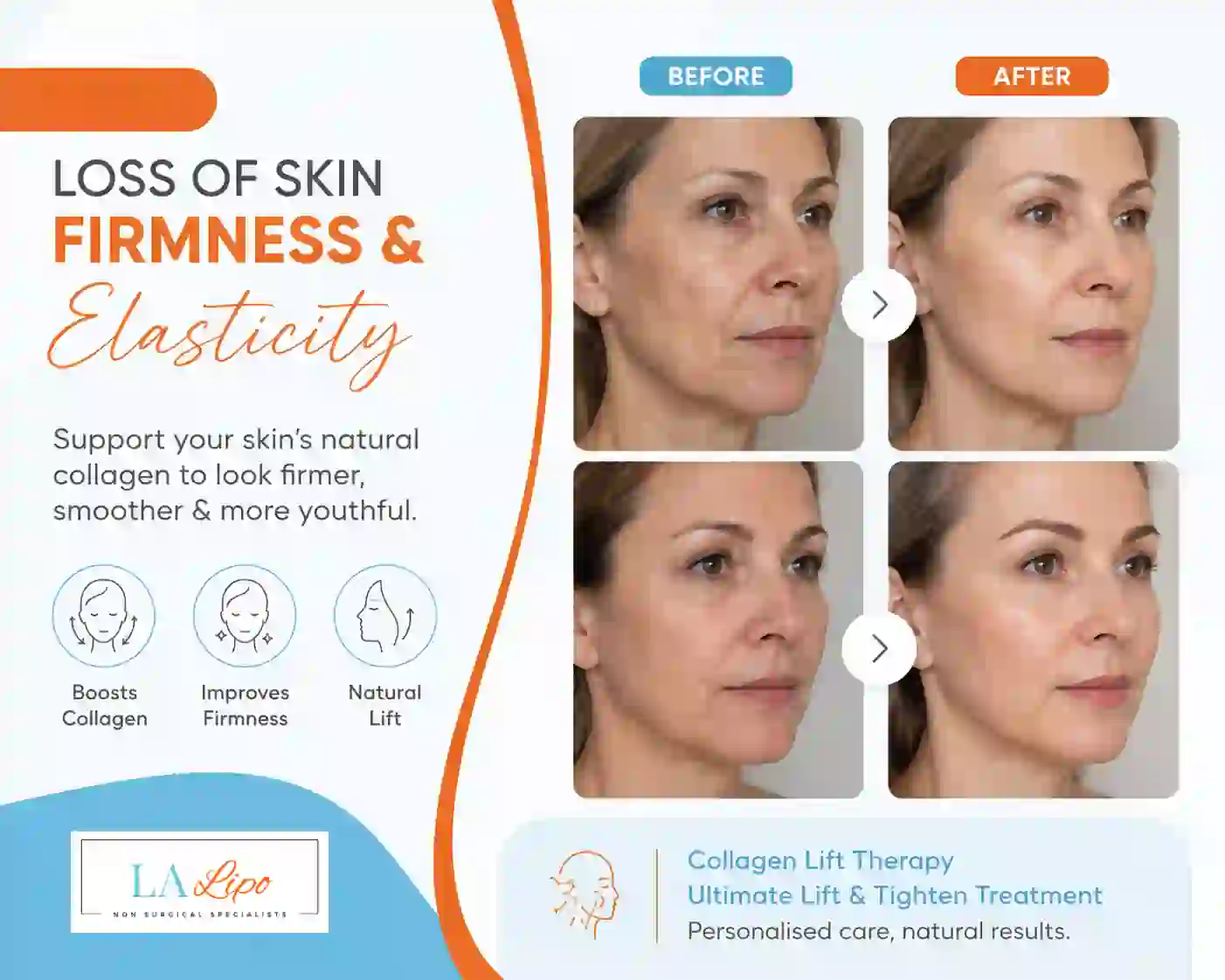 Sign #7: Loss of Skin Firmness and Elasticity Holmes Chapel
